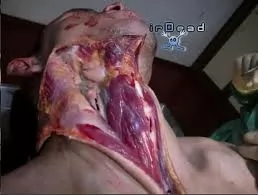 اهمیت-کالبد-شکافی-در-دادرسی-های-قضایی